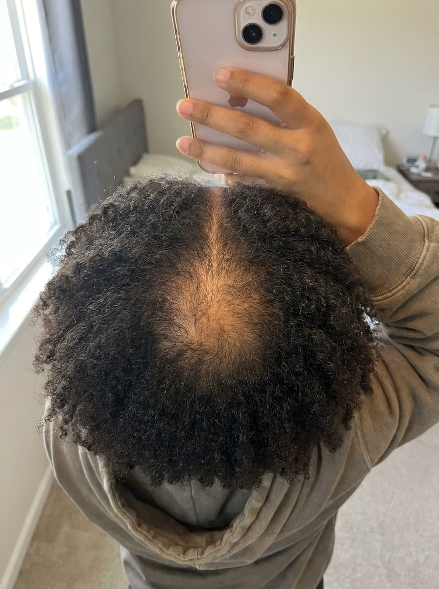 Crown fills back in — Before