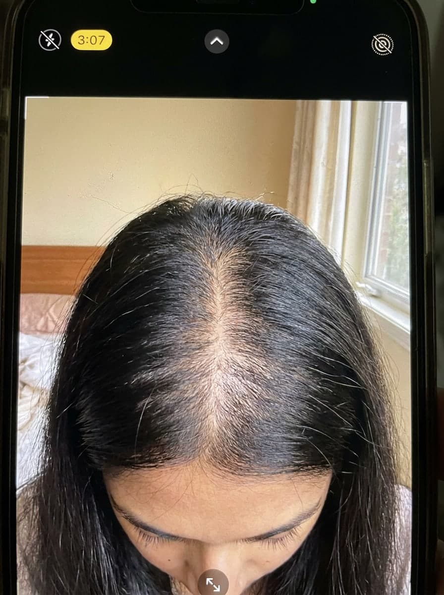 Center parting closes — Before