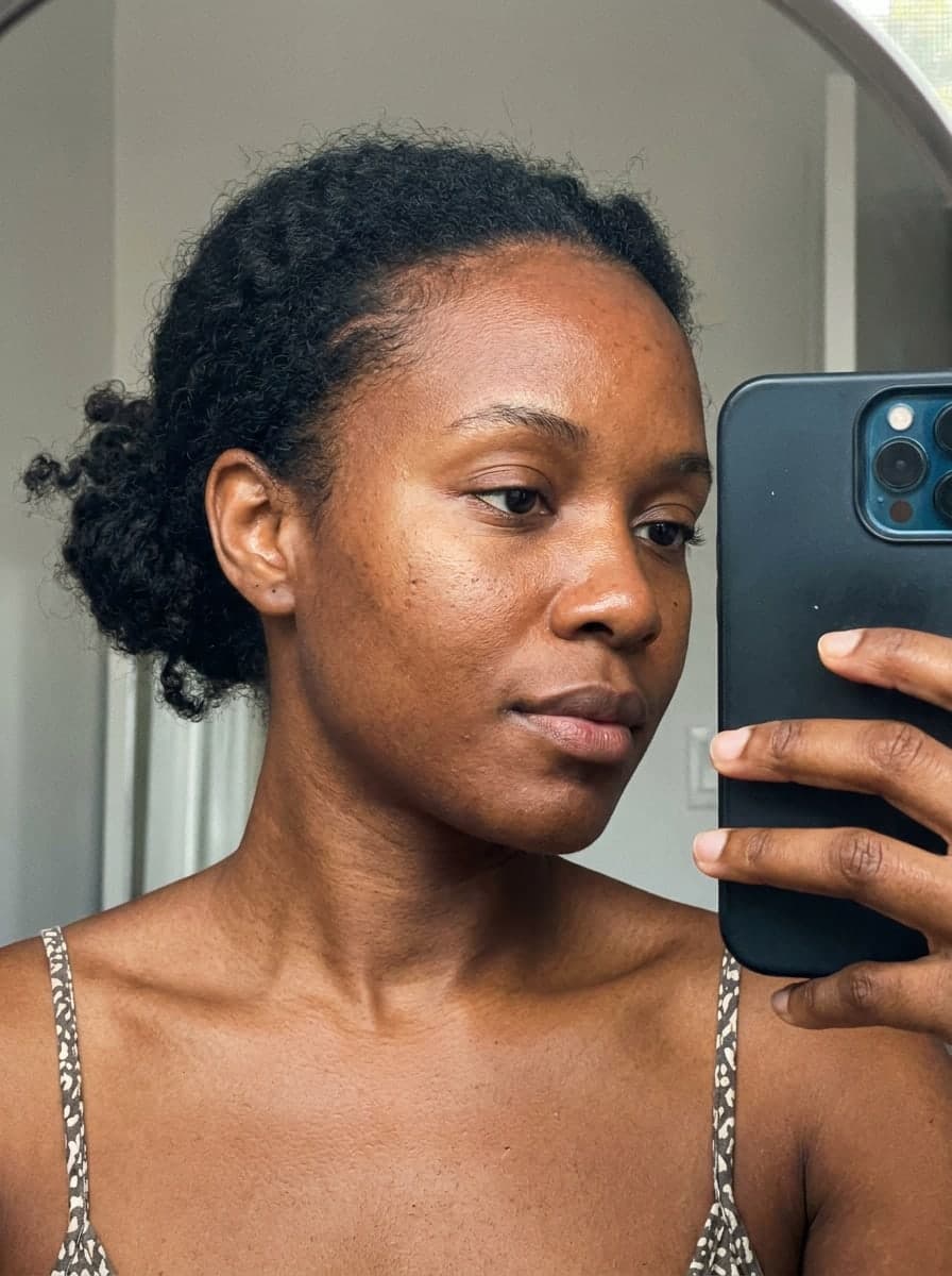 Baby hairs grow back — Before