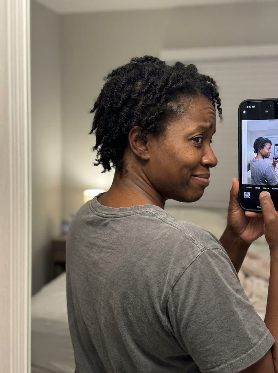 Nape grows back — Before